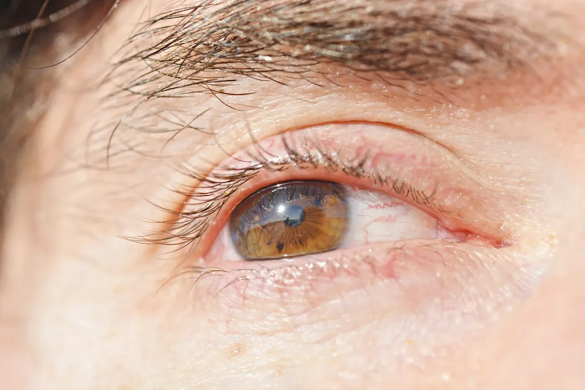 Detailed close-up of a brown human eye reflecting sunlight, showing intricate patterns.